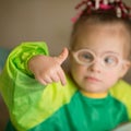 Quite a nice little girl with Down`s syndrome Royalty Free Stock Photo