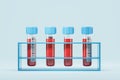 Rack with test tubes with blood samples Royalty Free Stock Photo