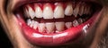 Radiant Smile: Close-Up of a Happy Mouth with White Teeth Royalty Free Stock Photo