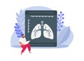 Radiogram Of Lungs Composition