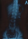 radiograph Royalty Free Stock Photo