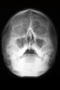 Radiographic view of the skull (head radiologram) Royalty Free Stock Photo
