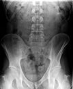 Radiography, x-ray of a vertebral column