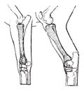 Radius and Tibia of a Horse, vintage engraving Royalty Free Stock Photo