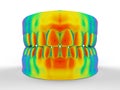 Rainbow colored denture