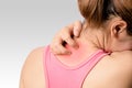 Rash on back and upper neck Royalty Free Stock Photo