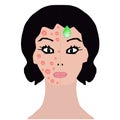 Rash on face. Allergy, dermatitis, acne, pimples. treatment. Infographics. Vector illustration on isolated background.