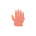 Rash hand, allergic reaction flat icon