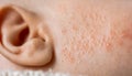 rash or red pimples allergic skin on baby cheek