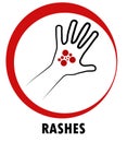 Rashes, symbol of disease, a hand with a rash in a ring, pictogram