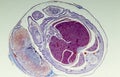 Rat uterus with embryo in histological