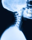 Ray x imaging of the cervical spine Royalty Free Stock Photo