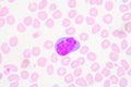 Reactive lymphocytes