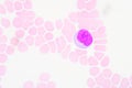 Reactive lymphocytes