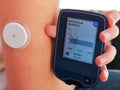 Reading a glucose  level with device for continuous glucose monitoring in blood Ã¢â¬â CGM. Royalty Free Stock Photo