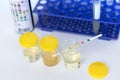 Reagent Strip for Urinalysis, Routine Urinalysis, urine test analysis in laboratory. Urine sample test. Royalty Free Stock Photo