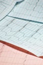 Real ECG Royalty Free Stock Photo