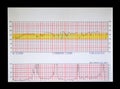 Real Fetal and Maternal Monitor strip