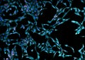 Real fluorescence microscopic view of human fibroblasts