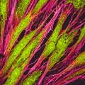 Confocal microscopy of fibroblast cells