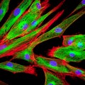 Confocal microscopy of fibroblast cells