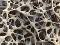 Realistic bone spongy structure close-up, bone texture affected by osteoporosis