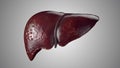 Realistic 3d animation of human liver sick stages from healthy to liver cirrhosis