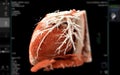 Realistic 3D Heart CTA Scan:.A detailed CTA scan showing the coronary arteries and heart structure, providing a comprehensive view