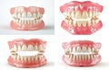 Realistic 3D Render of Dentures - Full Set of Artificial Teeth for Dental and Medical Use Royalty Free Stock Photo