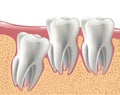 Realistic 3D teeth, and wisdom tooth problems Royalty Free Stock Photo