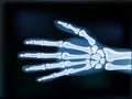 Realistic 2D X-ray Hand Dark Medical Image Royalty Free Stock Photo