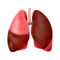 Realistic Damaged Lungs Composition