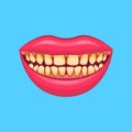 Realistic Detailed 3d Dental Problem on a Blue. Vector