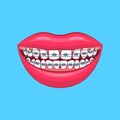 Realistic Detailed 3d Dental Problem on a Blue. Vector
