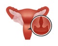 Realistic female human reproductive system on white background focus on cervix. Reproductive system with close-up cross