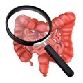 Realistic human intestines under a magnifying glass. 3D vector illustration of the colon. Studies of the gastrointestinal tract.