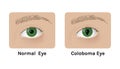 Realistic human normal eyes and with colomba vector illustration design