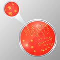 Realistic illustration of petri dish with bacteria isolated. Staphylococcus colony on the agar plate. Royalty Free Stock Photo