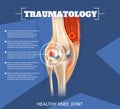 Realistic Illustration Traumatology Medicine in 3d Royalty Free Stock Photo