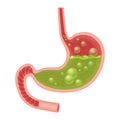 Realistic medical illustration of nausea stomach isolated. Green liquid inside stomach.