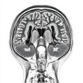 Realistic mri scan isolated on white background showcasing detailed anatomical structures and features