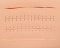 Realistic scars. Medical surgical sutures wounds close up pictures on human skin decent vector