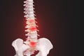 Realistic skeletal human spine and vertebral column or intervertebral discs on a dark background. Lower back pain. Vertebral