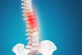 Realistic skeletal human spine and vertebral column or intervertebral discs on a dark background. Lower back pain. Vertebral