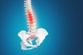 Realistic skeletal human spine and vertebral column or intervertebral discs on a dark background. Lower back pain. Vertebral