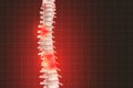 Realistic skeletal human spine and vertebral column or intervertebral discs on a dark background. Lower back pain. Vertebral