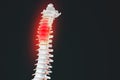 Realistic skeletal human spine and vertebral column or intervertebral discs on a dark background. Lower back pain. Vertebral