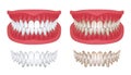 Realistic teeth. Isolated white 3D smile for orthodontics clinic, dentistry concept with white jaw render. Vector oral