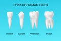 Realistic Teeth Types Set Royalty Free Stock Photo