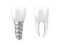 Realistic tooth and dental implant for stomatology or dentistry template, 3d rendering